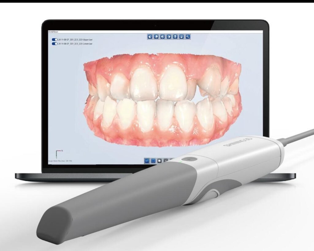 Shining 3D Intraoralscanner